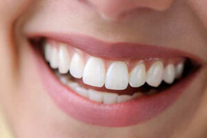 ZİRKONYUM DİŞ ZİRKONYUM DİŞ