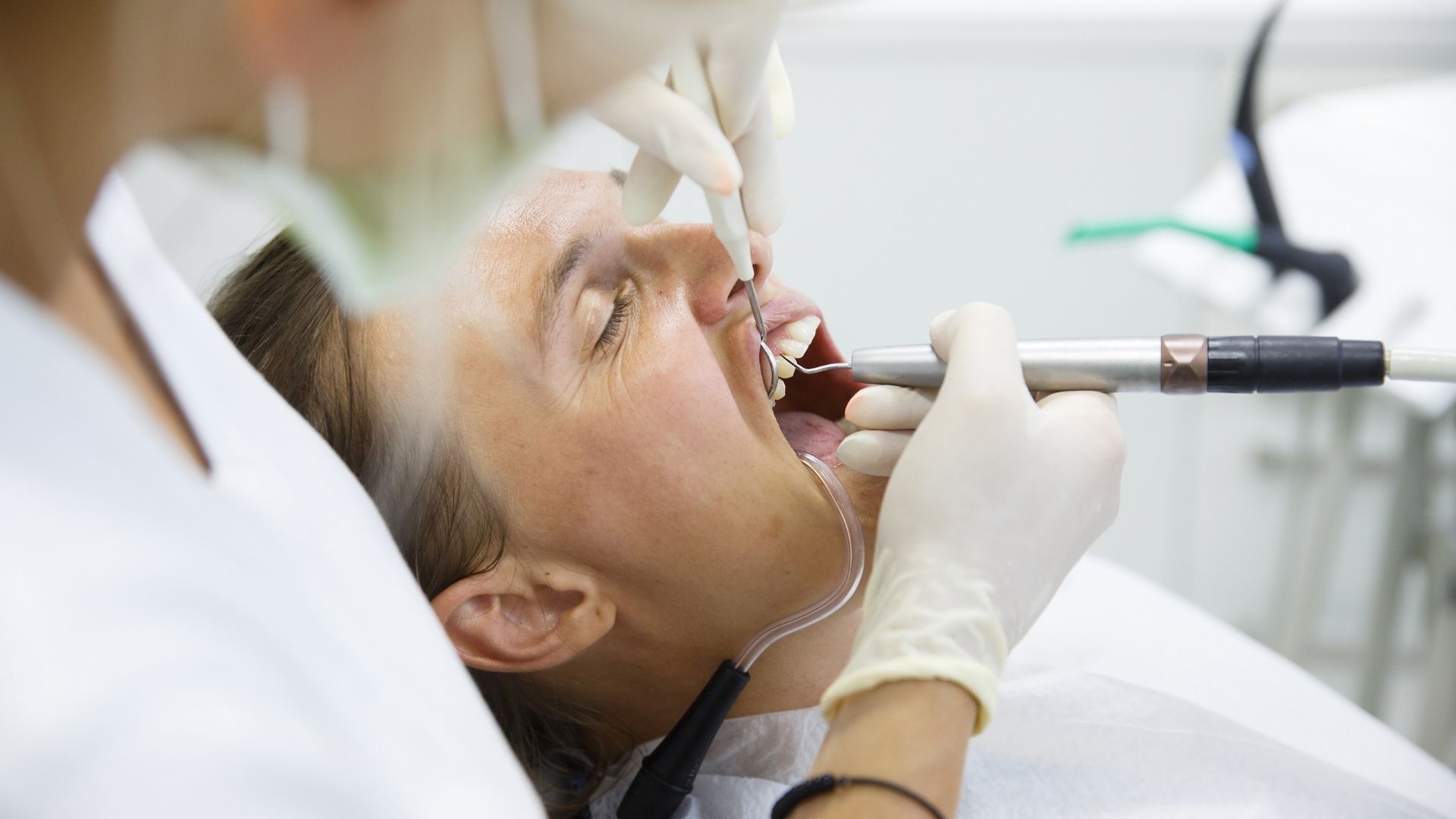 Diş Eti Hastalıkları