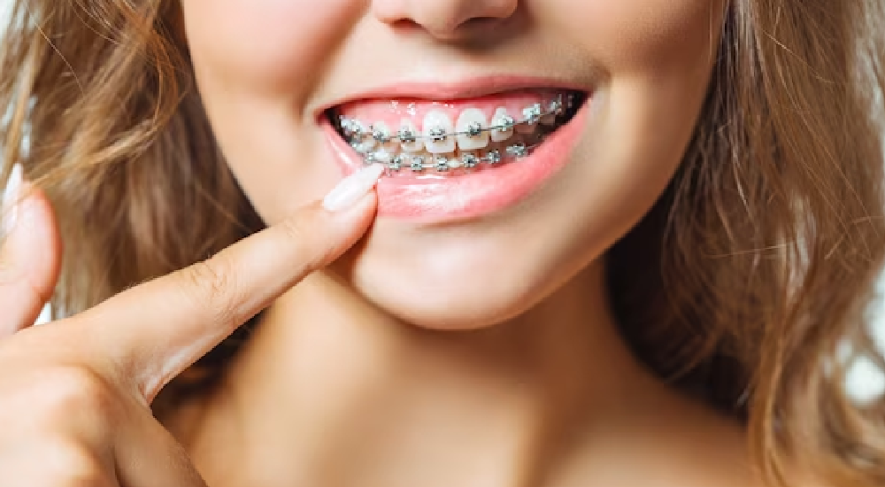 Esenyurt'ta
Hollywood Smile (Smile Design) Tedavileri ve Fiyatları